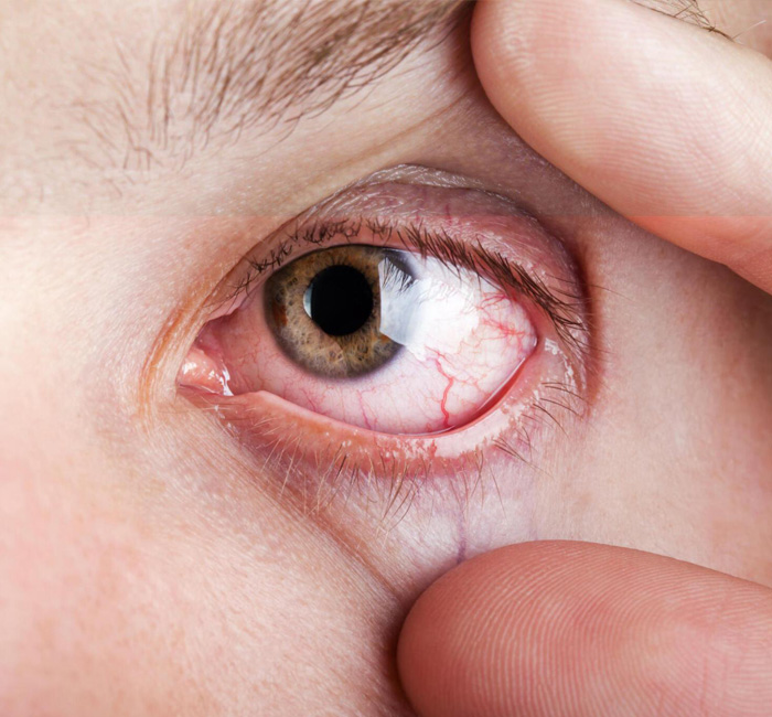Blood capillary human eye