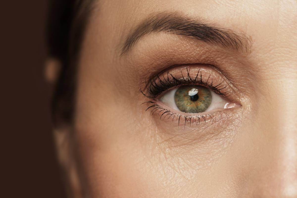 woman eye up close: ptosis or excess eyelid skin blog photo